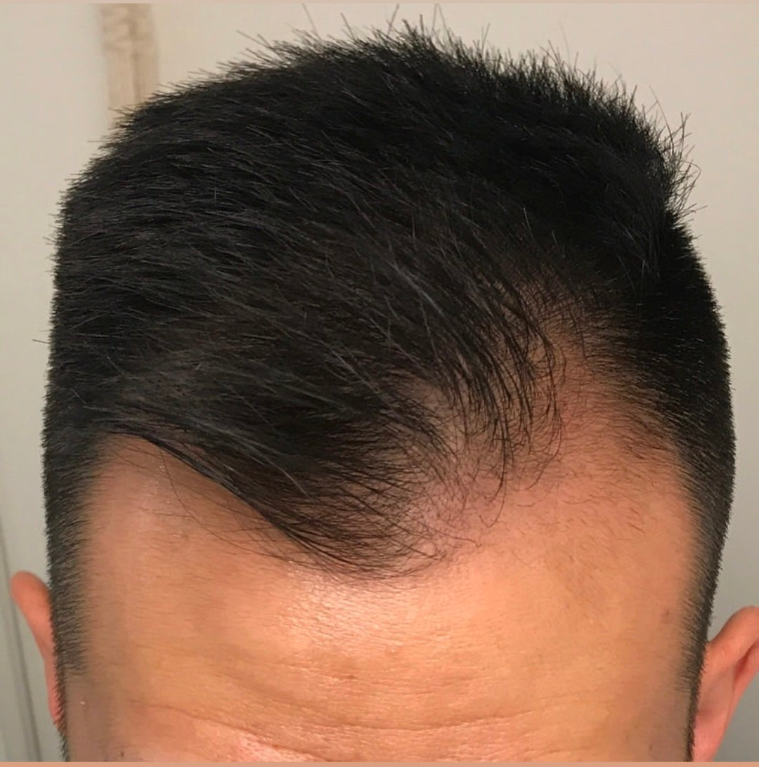 Hair food 7 herbal 0il               Stops hair fall within a week