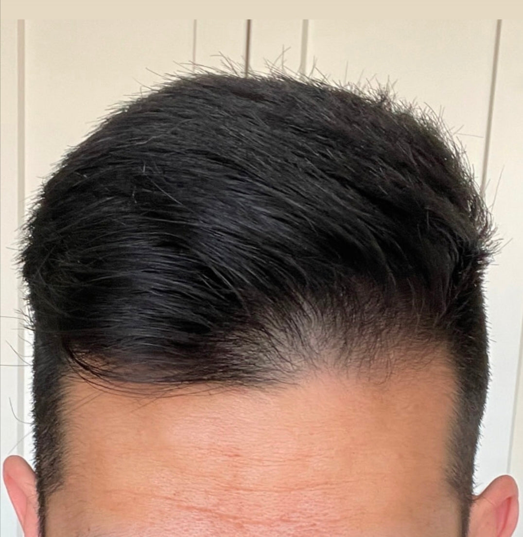 Hair food 7 herbal 0il               Stops hair fall within a week