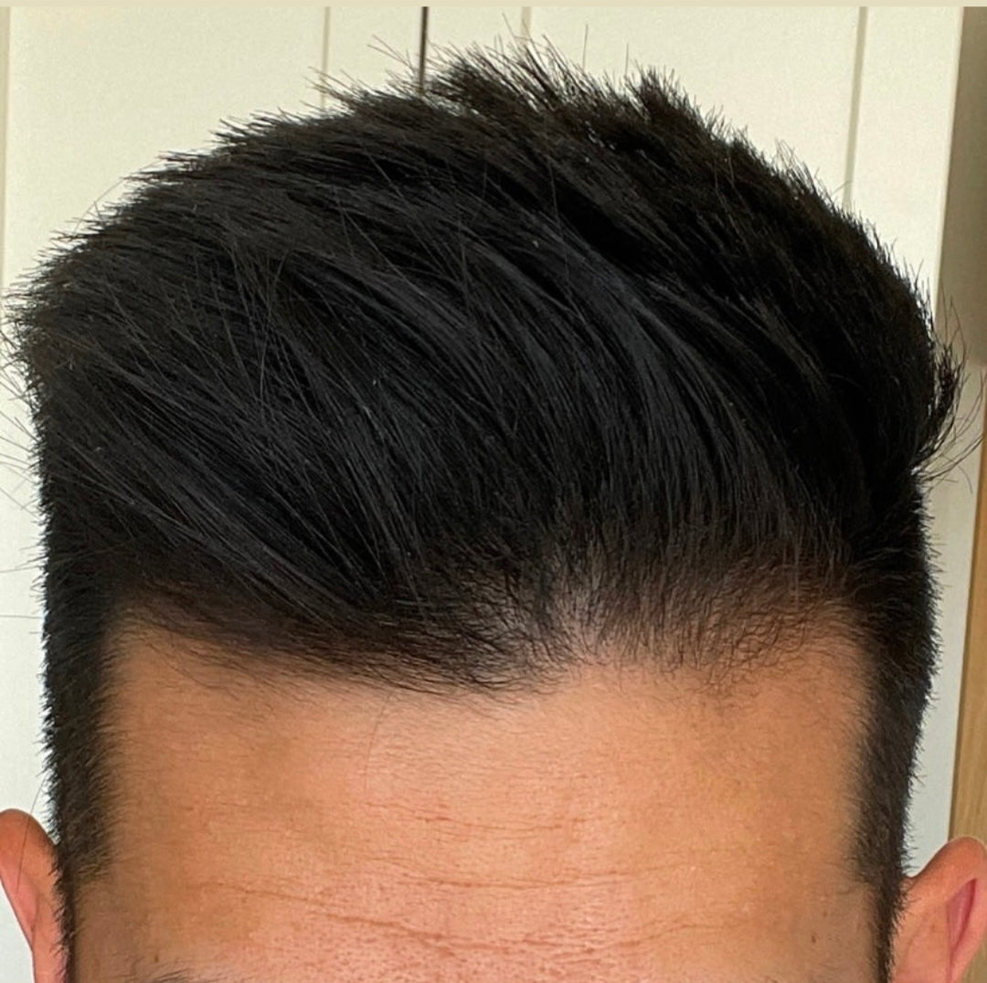 Hair food 7 herbal 0il               Stops hair fall within a week