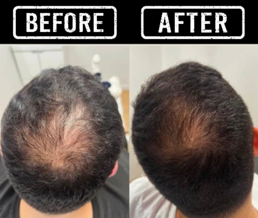 Hair food 7 herbal 0il               Stops hair fall within a week