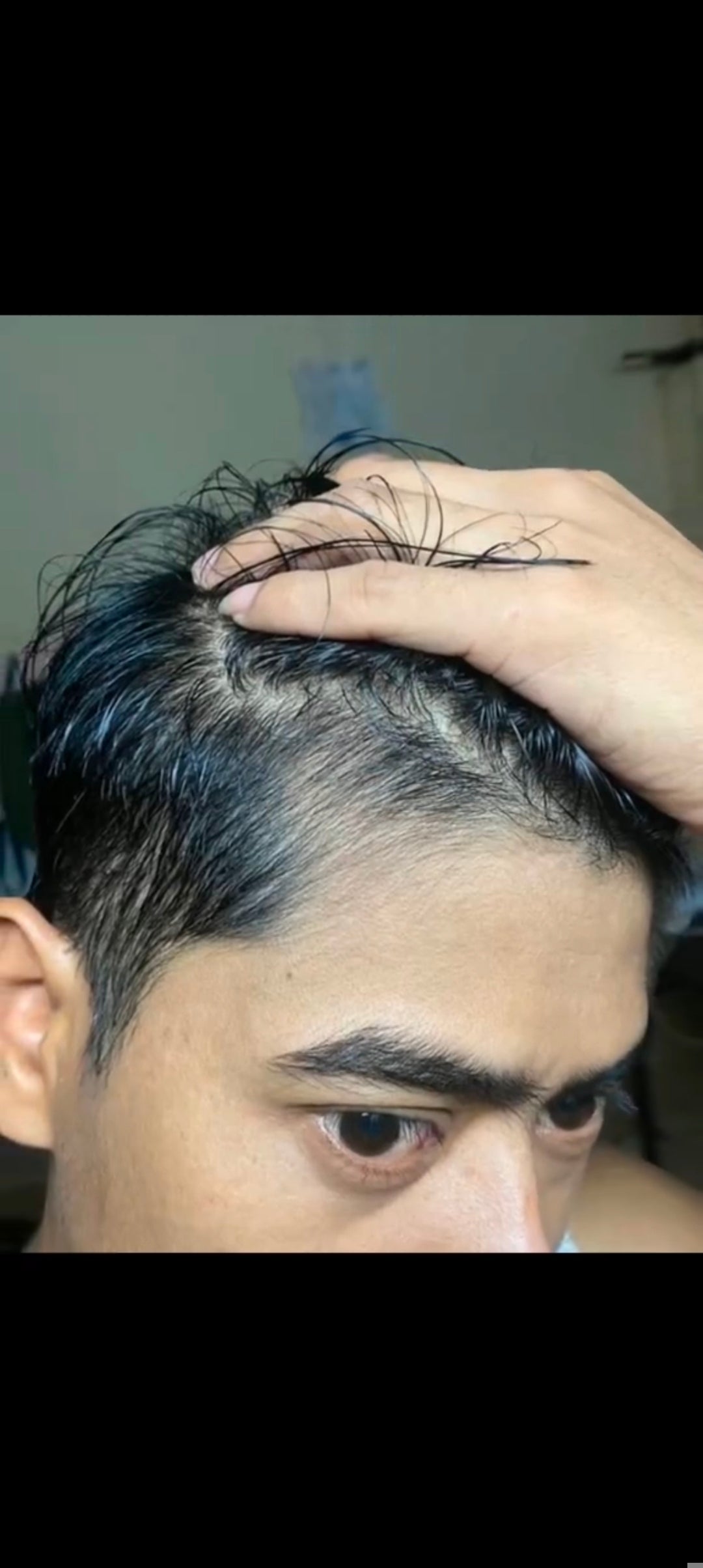 Hair food 7 herbal 0il               Stops hair fall within a week